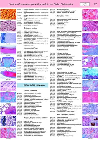 Lâminas Preparadas para Microscópio em Orden Sistemática 67 
Ho5432g 
Ho544e 
Ho549e 
Ho605f 
Ho610f 
Ho635d 
Ho637e 
Ho645e 
Pa4101e 
Pa4102e 
Pa4106e 
Pa4108e 
Pa4113g 
Pa4117e 
Pa4118e 
Pa4129e 
Pa4127e 
Pa4232e 
Pa4133e 
Pa4135e 
Pa4146e 
Pa4136e 
Ho542f • Gânglio simpático, humano s.t. coloração de 
rotina 
Ho5423g Gânglio simpático, humano s.t. coloração com 
prata 
Ho543f Gânglio espinhal, humano s.t. coloração de 
rotina 
Ho5432g Gânglio espinhal, humano s.t. coloração com 
prata 
Ho544e • Nervo periférico, humano s.t. 
Ho545e Nervo periférico, humano s.l. 
Ho5453f Nervo periférico, humano s.t. e s.l. 
Ho549e • Nervo óptico, humano s.t. 
Órgãos do sentido 
Ho605f • Retina do olho humano s.t. * 
Ho607e • Córnea do olho humano s.t. 
Ho610f Papilas gustativas, humano s.t. * 
Ho612f • Epitélio olfatório, humano s.t. 
Ho6103g Ouvido Interno, feto humano, s.t. * 
Ho5572t Nervos e terminações nervosas em sec. da 
pele da palma, prata * 
Ho5573f • Corpúsculos táteis na pele humana, s. t., co-loração 
de rotina 
Ho5574t Corpúsculos táteis na pele humana, s.t. co-loração 
com prata * 
Integumento (Pele) 
Ho632e • Pele da ponta do dedo, humano, s.l.vertical 
Ho633e Pele da palma humana, s.l. vertical 
Ho6334d • Pele do corpo, branco, s.l. vertical 
Ho6335d Pele do corpo, negra, s.l. vertical 
Ho6336f Pele do corpo, branca e negra, duas s.l. verti-cal 
Ho634e Pele de axila com glândulas apócrinas, s.l. 
vertical 
Ho635d • Couro cabeludo, s.l. vert. mostra s.l. de folícu-lo 
de cabelo, humano 
Ho636d • Couro cabeludo, s.l. horizontal mostra s.t. de 
folículo de cabelo 
Ho637e Couro cabeludo de feto humano, s.l. vertical 
mostra s.l. de cabelos 
Ho638e • Ponta do dedo de feto humano, s.l. sag. de-senvolvimento 
de unha 
Ho639f Unha do dedo da mão s.l. 
Ho640e Pálpebra, humano, s.t. 
Ho645e • Glândula mamária, ativa, humano s.t. 
Ho646e Glândula mamária, repouso, humano s.t. 
Ho648e Glândula mamária, senil, humano s.t. 
PATOLOGIA HUMANA 
Pulmão e traquéia 
Pa4101e Tuberculose miliar do pulmão 
Pa4102e Antracose do pulmão 
Pa4152e Pulmão de carvão tuberculoso 
Pa4103e Pneumonia Croupous 
Pa4104e Cavidade pulmonar tuberculosa crônica 
com bactérias* 
Pa4105e Cyanotic induration do pulmão 
Pa4106e Pneumonia crônica 
Pa4107e Efisema pulmonar crônico 
Pa4108e Infarto hemorrágico do pulmão 
Pa4109e Pneumonia necrótica 
Pa4110e Pneumonia Influenzal 
Pa4180e Pneumonia, sec. de pulmão 
Pa4250e Abscessus lumbalis 
Pa4153e Carcinoma do pulmão 
Pa4182f Difteria, sec. de traquéia * 
Sangue, baço e sistema linfático 
Pa4112e Infarto do baço 
Pa4115e Degeneração amiloide do baço 
Pa4123e Erisipela do baço 
Pa4113g Melanemia malarial do baço 
Pa4111e Sarcoma mielóide do baço 
Pa4117e Leucemia mielóide crônica de baço 
Pa4124e Tuberculose de glândulas linfáticas 
Pa4121e Lymphangio-endothelioma do pescoço 
Pa4126e Sarcoma mielóide do nódulo linfático 
Pa4120e Lymphosarcoma mediastini 
Pa4167e Tonsilite, sec. de tonsila palatina 
Pa4122e Myxoma mandibulae 
Pa4162g Leucemia, esfregaço de sangue * 
Pa4163g Anemia, esfregaço de sangue * 
Coração e veias 
Pa4114e Miocardite crônica aguda recidivante 
Pa4116e Adipose do coração 
Pa4118e Calosidade cardíaca 
Pa4119e Cor villosum 
Pa4160e Arteriosclerose 
Glândulas 
Pa4129e Goiter de glândula tiróide, estruma colóide 
Pa4165e Estruma nodosa, glândula tiróide 
Pa4164e Adenoma de glândula tiróide, sec. 
Pa4125e Carcinoma scirrhosum de glândula tiróide 
Pa4127e Tumor misto fibroepitelial de glândula pa-rótida 
Pa4128e Carcinoma medular glândular 
Pa4232e Fibroadenoma do seio 
Pa4237e Fibroadenoma intracanalicular de mama 
Pa4234e Carcinoma scirrhosum do seio 
Pa4247e Carcinoma solidum simplex do seio 
Pa4159e Adenoma da glândula adrenal 
Trato intestinal 
Pa4147e Esofagite necrótica 
Pa4155e Carcinoma do estômago 
Pa4154e Carcinoma do intestino grosso 
Pa4137e Adenocarcinoma do cólon 
Pa4184e Engrossamento do intestino 
Pa4185f Sangramento do intestino por envenena-mento 
sublimado 
Pa4166e Inflamação do apêndice 
Pa4132e Carcinoma gelatinoso do reto 
Pa4138e Colite disentérica Shiga-Kruse 
Fígado 
Pa4130e Tuberculose miliar do fígado 
Pa4172e Degeneração gordurosa do fígado 
Pa4133e Degeneração gordurosa e parenquimatosa 
do fígado 
Pa4148e Degeneração parenquimatosa do fígado 
Pa4143e Degeneração amiloide do fígado 
Pa4203e Cirrose do fígado 
Pa4134e Cirrose pigmentar do fígado 
Pa4141e Atrofia cyanotica de fígado (fígado de nos-moscada) 
Pa4144e Atrofia marron do fígado 
Pa4142e Necrose hemorrágica do fígado (eclampsia) 
Pa4135e Hemosiderose do fígado 
Pa4146e Ictericia - hepate 
Pa4149e Hemangioma cavernoso do fígado 
Pa4173e Carcinoma do fígado 
Pa4140e Carcinoma primário do fígado 
Pa4136e Metastase do fígado 
Pa4174e Metastase Peritoneal do hepatoma 
Pa4201e Metastase do Fígado de um melanosarco-ma 
recti 
Pa4145e Leucemia linfática do fígado 
Pa4191e Inflamação da vesícula, 
Pa4202e Tumor maligno da vesícula 
Pa4150f Sífilis congenita do fígado, espiroquetas 
coradas por Levaditi * 
Pa4131g Sífilis congenita do fígado, coradas com prata 
para espiroquetas * 
Pa4139f Cirrose hepática luetica (Sífilis ) * 
Rins e aparelho urinário 
Pa4213e Tuberculose do rim 
Pa4215e Degeneração parenquimatosa do rim 
Pa4207e Degeneração amiloide do rim 
Pa4218e Glicogenose do rim 
Pa4216e Nefrite aguda 
Pa4217e Nefrite hemorrágica aguda (sangramento do 
rim) 
Pa4206e Glomerulonefrite Crônica 
Pa4210e Nefrite embólica séptica 
Pa4205e Rim cardíaco (icterus) 
Pa4219e Glomerularatrofia do rim (cirrose) 
Pa4221e Hipernefroma do rim 
Pa4175g Sífilis do rim 
Pa4181e Papiloma da bexiga urinária 
 
