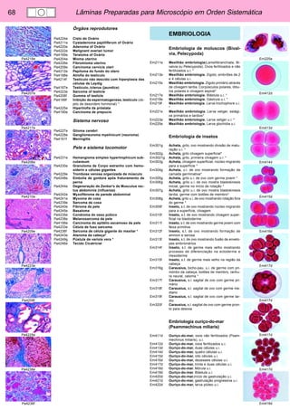 68 Lâminas Preparadas para Microscópio em Orden Sistemática 
Em225e 
Em412d 
Em413d 
Em414d 
Em415d 
Em416d 
Em417d 
Em417d 
Em417d 
Em417d 
Em418d 
Pa4218e 
Pa4207e 
Pa4217e 
Pa4206e 
Pa4210e 
Pa4209e 
Pa4223e 
Pa4208f 
Pa4225e 
Pa4238e 
Pa4236f 
Órgãos reprodutores 
Pa4224e Cisto do Ovário 
Pa4211e Cystadenoma papilliferum of Ovário 
Pa4220e Adenoma of Ovário 
Pa4222e Malignant ovarian tumor 
Pa4169e Teratoma of Ovário 
Pa4204e Mioma uterino 
Pa4226e Fibromioma uterino 
Pa4209e Carcinoma cervicis uteri 
Pa4212e Papiloma do fundo do útero 
Pa4188e Atrofia do testículo 
Pa4214f Testículo não descido com hiperplasia das 
células de Leydig 
Pa4187e Testículo, icterus (jaundice) 
Pa4223e Sarcoma of testicle 
Pa4208f Gumma of testicle 
Pa4189f Inibição da espermatogenese, testículo (ob-jeto 
de desordem hormonal) * 
Pa4225e Hipertrofia da próstata 
Pa4190e Carcinoma de prepucio 
Sistema nervoso 
Pa4227e Glioma cerebri 
Pa4228e Ganglioneuroma myelinicum (neuroma) 
Pa4161f Meningitis 
Pele e sistema locomotor 
Pa4231e Hemangioma simplex hypertrophicum sub-cutaneum 
Pa4230e Granuloma de Corpo estranho com hemo-siderin 
e células gigantes 
Pa4229e Trombose venosa organizada de músculo 
Pa4248e Embolia de gordura após fraturamento de 
perna 
Pa4244e Degeneração de Zenker’s de Musculus rec-tus 
abdominis (influenza) 
Pa4242e Myxofibroma de parede abdominal 
Pa4241e Myxoma de coxa 
Pa4239e Sarcoma de coxa 
Pa4240e Fibroma da pele 
Pa4245e Basaloma 
Pa4235e Condroma do osso púbico 
Pa4238e Melanosarcoma da pele 
Pa4156e Carcinoma do epitélio escamoso da pele 
Pa4233e Célula de fuso sarcoma 
Pa4236f Sarcoma de célula gigante do maxilar * 
Pa4243e Ateroma da cabeça* 
Pa4249g Pústula de variola vera * 
Pa4246e Tecido Cicatricial 
EMBRIOLOGIA 
Embriologia de moluscos (Bival-via, 
Pelecypoda) 
Em211e Mexilhão embriologia(Lamellibranchiata, Bi-valvia 
ou Pelecypoda). Ovos fertilizados e não 
fertilizados u.i. * 
Em213e Mexilhão embriologia. Zigoto, embriões de 2 
e 4 células u.i. 
Em215s Mexilhão embriologia. Zigoto primário através 
de clivagem tardia. Corpúsculos polares, lóbu-los 
polares e clivagem espiral* 
Em217e Mexilhão embriologia. Blástula u.i. * 
Em218e Mexilhão embriologia. Gástrula u.i. * 
Em219f Mexilhão embriologia. Larva trochophore u.i. 
* 
Em221s Mexilhão embriologia. Larva veliger, estági-os 
primários e tardios* 
Em223e Mexilhão embriologia. Larva veliger u.i. * 
Em225e Mexilhão embriologia. Larva glochidia u.i. 
Embriologia de insetos 
Em301g Acheta, grilo, ovo mostrando divisão de matu-ração 
u.i. * 
Em302g Acheta, grilo clivagem superficial* 
Em3021g Acheta, grilo, primeira clivagem u.i. * 
Em303g Acheta, clivagem superficial, núcleo migrando 
para a superfície * 
Em304g Acheta, u.i. de ovo mostrando formação de 
camada germinativa* 
Em305g Acheta, grilo u.i. de ovo com germe jovem * 
Em306g Acheta, grilo u.i. de ovo mostra blastokinesis 
inicial, germe no início de rotação * 
Em307g Acheta, grilo u.i. de ovo mostra blastokinesis 
tardia, germe com botões de membro* 
Em308g Acheta, grilo u.i. de ovo mostrando rotação fora 
do germe * 
Em309f Inseto, s.t. de ovo mostrando núcleo migrando 
para a superfície, clivagem 
Em310f Inseto, s.t. de ovo mostrando clivagem super-ficial 
na blastoderme 
Em311f Inseto, s.t. de ovo mostrando germe jovem com 
faixa primitiva 
Em312f Inseto, s.t. de ovo mostrando formação de 
amnion e serosa 
Em313f Inseto, s.t. de ovo mostrando fusão de envelo-pes 
embrionários 
Em314f Inseto, s.t. de germe mais velho mostrando 
processo de diferenciação na ectoderme e 
mesoderme 
Em315f Inseto, s.t. de germe mais velho na região da 
cabeça 
Em316g Carausius, bicho-pau, u.i. de germe com pri-mórdio 
da cabeça, botões de membro, ranhu-ra 
neural, celoma * 
Em317f Carausius, s.l. sagital de ovo com germe pri-mário 
Em318f Carausius, s.l. sagital de ovo com germe me-diano 
Em319f Carausius, s.l. sagital de ovo com germe tar-dio 
Em320f Carausius, s.l. sagital de ovo com germe pron-to 
para desova 
Embriologia ouriço-do-mar 
(Psammechinus miliaris) 
Em411d Ouriço-do-mar, ovos não fertilizados (Psam-mechinus 
miliaris), u.i. 
Em412d Ouriço-do-mar, ovos fertilizados u.i. 
Em413d Ouriço-do-mar, duas células u.i. 
Em414d Ouriço-do-mar, quatro células u.i. 
Em415d Ouriço-do-mar, oito células u.i. 
Em416d Ouriço-do-mar, dezesseis células u.i. 
Em417d Ouriço-do-mar, trinta e duas células u.i. 
Em418d Ouriço-do-mar. Mórula u.i. 
Em419d Ouriço-do-mar. Blástula u.i. 
Em420d Ouriço-do-mar,início de gastrulação u.i. 
Em421d Ouriço-do-mar, gastrulação progressiva u.i. 
Em422d Ouriço-do-mar, larva plúteo u.i. 
 