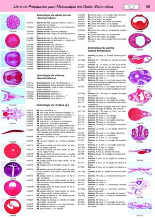 Lâminas Preparadas para Microscópio em Orden Sistemática 69 
Em418d 
Em419d 
Em420d 
Em421d 
Em422d 
Em452f 
Em528g 
Em603f 
Em604f 
Em606f 
Em608f 
Em609f 
Em615f 
Em617g 
Em621f 
Em622f 
Em623f 
Em625e 
Em628f 
Em705f 
Em706f 
Em711f 
Embriologia de estrela do mar 
(Asterias rubens) 
Em431d Estrela do mar (Asterias rubens). ovário s.t. 
mostrando ovo grande 
Em432d Estrela do mar testículo s.t. com desenvolvi-mento 
de esperma 
Em434e Estrela do mar. esperma, esfregaço 
Em435e Estrela do mar estágio de vesícula germinal 
u.i. 
Em436e Estrela do mar ovo não fertilizado u.i. 
Em437e Estrela do mar ovo fertilizado u.i. Zigoto com 
corpúsculos polares 
Em438e Estrela do mar duas células u.i. 
Em439e Estrela do mar quatro células u.i. 
Em440e Estrela do mar oito células u.i. 
Em441e Estrela do mar dezesseis células u.i. 
Em443e Estrela do mar trinta e duas células u.i. 
Em444e Estrela do mar sessenta e quatro células u.i. 
Em447e Estrela do mar blástula primária e tardia u.i. 
Em448e Estrela do mar gástrula primária e tardia u.i. 
Em451f Estrela do mar larva bipinnaria jovem u.i. 
Em452f Estrela do mar larva bipinnaria tardia u.i. 
Em456s Estrela do mar larva Brachiolaria u.i. 
Em458s Estrela do mar estrela do mar jovem u.i. 
Embriologia de anfioxos 
(Branchiostoma) 
Em511g Branchiostoma. ovos não fertilizados u.i. * 
Em516k Branchiostoma. duas e dezesseis células u.i. * 
Em519g Branchiostoma. trinta e duas e sessenta e 
quatro células u.i. * 
Em522g Branchiostoma. blástula u.i. * 
Em524g Branchiostoma. gástrula u.i. * 
Em526g Branchiostoma. larva primária u.i. * 
Em528g Branchiostoma. larva tardia u.i. * 
Embriologia de rã (Rana sp.) 
Em601f Rã, ovo, uma célula, s.t. 
Em602f Rã, ovo, duas células (primeira clivagem) s.l. 
Em603f Rã, ovo, quatro células (segunda clivagem) s.t. 
Em604f Rã, ovo, oito células (terceira clivagem) s.l. 
Em6045f Rã, ovo, dezesseis células s.l. 
Em605f Rã, mórula, s.l. com macro- e micrômeros 
Em606f Rã, blástula s.l. mostrando blastocele 
Em607f Rã, gástrula primária, s.l. sagital mostra forma-ção 
de camadas germinativas e lábio dorsal 
Em608f Rã, gástrula tardia (estagio gema), s.l.sagital 
com camadas germinativas, gema, blastocele, 
cavidade intestinal primária 
Em609f Rã, neurula primária, s.t. mostrando o sulco 
neural 
Em610f Rã, neurula mediana, s.t. mostra a cavidade 
neural 
Em611f Rã, neurula tardia com tubo neural, s.t. atra-vés 
da região intestinal 
Em612f Rã, neurula tardia com tubo neural, s.t. atra-vés 
da região frontal 
Em613f Rã, neurula tardia com tubo neural, s.l. sagital 
Em614f Rã, estágio precoce do botão caudal, s.t. da 
região da cabeça 
Em615f Rã, estágio precoce do botão caudal, s.t. da 
região do corpo 
Em616f Rã, estágio precoce do botão caudal, s.l. sagi-tal 
Em617g Rã, estágio precoce do botão caudal, s.l. sagi-tal 
com cérebro, tubo neural, notocorda, trato 
digestivo* 
Em618f Rã, estágio tardio do botão caudal, s.t. da re-gião 
da cabeça 
Em619f Rã, estágio tardio do botão caudal, s.t. da re-gião 
do corpo com processos de diferenciação 
na mesoderme 
Em6195f Rã, estágio tardio do botão caudal, s.t. na re-gião 
do pronefros 
Em620f Rã, estágio tardio do botão caudal, s.l. frontal 
com diferenciação da bolsa celômica 
Em621f Rã, estágio de desova, s.t. da cabeça com de-senvolvimento 
dos olhos 
Em622f Rã, estágio de desova, s.t. através da região 
do coração , brânquias 
Em623f Rã, estágio de desova, s.t. do meio do corpo 
Em624f Rã, estágio de desova, s.l. sagital 
Em625e Rã, girino jovem, s.t. da cabeça 
Em626e Rã, girino jovem, s.t. da região das brânquias 
Em627e Rã, girino jovem, s.t. do abdomen 
Em628f Rã, girino jovem, sec.sagital 
Em629f Rã, girino jovem, sec.frontal (horizontal) 
Em630e Rã, girino mais velho, s.t. da cabeça 
Em631e Rã, girino mais velho, s.t. da região das brân-quias 
Em632e Rã, girino mais velho, s.t. na região do coração 
e pulmões 
Em633e Rã, girino mais velho, s.t. do abdomen 
Em6333f Rã, girino mais velho, sec.sagital 
Em634f Rã, girino mais velho, secção através de botão 
do limbo 
Embriologia da galinha 
(Gallus domesticus) 
Em701f Galinha, 12 horas, s.t. através de estria primi-tiva 
Em702g Galinha, 12 – 24 horas, s.l. através de estria 
primitiva * 
Em703f Galinha, 12 – 24 horas, s.t. com sulco neural 
Em704f Galinha, 24 horas, s.t. com cavidade neural, 
notocorda, camadas germinativas, c 
Em7042f Galinha, 24 horas, s.t. da região da cabeça 
Em7043f Galinha, 24 horas, s.t. da região intestinal 
Em7044f Galinha, 24 horas, s.t. da região pericardial. 
Em7047f Galinha, 24 horas, s.l. 
Em705f Galinha, 36 horas, s.t. com tubo neural, noto-corda, 
diferenciação na mesoderme (miótomo, 
nefrotom e splanchnotom) 
Em706f Galinha, 36 horas, s.t. da região anterior com 
desenvolvimento do coração (região pericardi-al) 
Em708g Galinha, 36 – 48 horas, s.l.sagital, formação 
de somitos * 
Em709f Galinha, 48 horas, s.t. da cabeça 
Em710f Galinha. 48 horas, s.t. da região do coração 
Em711f Galinha, 48 horas, s.t. mostrando tubo neural, 
mesoderme 
Em712g Galinha, 48 horas, s.l.sagital através do nódulo 
primitivo, formação do celoma, veia terminal * 
Em713g Galinha, 48 – 60 horas, s.l. horiz. com cére-bro, 
coração, e somitos 
Em714f Galinha, 60 horas, s.t. da cabeça 
Em715f Galinha, 60 horas, s.t. of coração 
Em716f Galinha, 60 horas, s.t. da região abdominal 
Em717f Galinha, 72 horas, s.t. do cérebro 
Em718f Galinha, 72 horas, s.t. na região do coração e 
olhos 
Em719f Galinha, 72 horas, s.t. na região caudal do 
coração 
Em720f Galinha, 72 horas, s.t. na região abdominal 
Em722g Galinha, 72 horas, s.l. horizontal 
Em723f Galinha, 4 – 5 dias, s.t. . da cabeça 
Em724f Galinha, 4 – 5 dias, s.t. na região do coração e 
olhos 
Em725f Galinha, 4 – 5 dias, s.t. da região abdominal 
Em726g Galinha, 4 – 5 dias, s.l. sagital* 
Em727f Galinha, 8 dias, s.t. do cérebro 
Em728f Galinha, 8 dias, s.t. através dos olhos 
Em729f Galinha, 8 dias, s.t. na região das fendas bran-quiais 
Em730f Galinha, 8 dias, s.t. na região do coração e 
pulmões 
Em731f Galinha, 8 dias, s.t. na região do intestino e 
fígado 
Em732f Galinha, 8 dias, s.t na região do intestino e 
rim 
Em733g Galinha, 8 dias, s.l. sagital de espécima intei-ro* 
Em751h Galinha, 16 horas, u.i. mostrando estria primi-tiva 
* 
Em752h Galinha, 18 horas, u.i. * 
Em753i Galinha, 21 horas, u.i. * 
Em754i Galinha, 24 horas, u.i. mostrando cavidade 
neural* 
Em756g Galinha, 28 horas, u.i. mostrando coração e 
vasos sanguíneos * 
Em758i Galinha, 33 horas, u.i. formação de somitos * 
Em760g Galinha, 40 horas, u.i. flexão da extremidade 
anterior * 
Em761i Galinha, 43 horas, u.i. * 
Em762i Galinha, 48 horas, u.i. formação do celoma* 
Em764h Galinha, 56 horas, u.i. arcos branquiais podem 
ser vistos* 
 