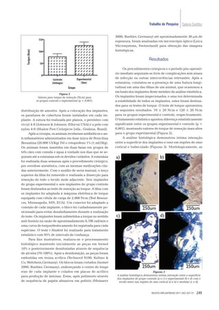 Trabalho de Pesquisa Caderno Cientíﬁco


                                                                 3000, Buehler, Germany) até aproximadamente 30 µm de
                                                                 espessura, foram analisadas em microscópio óptico (Leica
                                                                 Microsystems, Switzerland) para obtenção das imagens
                                                                 histológicas.

                                                                                            Resultados

                                                                       Os procedimentos cirúrgicos e o período pós-operató-
                                                                 rio imediato seguiram-se livre de complicações sem sinais
                                                                 de infecção ou outras intercorrências relevantes. Após a
                                                                 eutanásia, constatou-se a presença de uma fratura longi-
                                                                 tudinal em uma das tíbias de um animal, que ocasionou a
                                                                 exclusão dos implantes deste membro da análise estatística.
                             Figura 2
           Valores para torque de remoção (Ncm) para             Os implantes foram inspecionados, e uma vez determinada
          os grupos controle e experimental (p < 0.001).         a estabilidade de todos os implantes, estes foram destina-
                                                                 dos para os testes de torque. O teste de torque apresentou
distribuição de amostra. Após a colocação dos implantes,         os seguintes resultados: 70 ± 20 Ncm e 120 ± 20 Ncm
os parafusos de cobertura foram instalados em cada im-           para os grupos experimental e controle, respectivamente.
plante. A sutura foi realizada por planos, o periósteo com       O tratamento estatístico apontou diferença estatisticamente
vicryl 4-0 (Johnson & Johnson, Ethicon USA) e a pele com         signiﬁcante entre os grupos experimental e controle (p <
nylon 4-0 (Shalon Fios Cirúrgicos Ltda., Goiânia, Brasil).       0,001), mostrando valores de torque de remoção mais altos
      Após a cirurgia, os animais receberam antibióticos e an-   para o grupo experimental (Figura 2).
ti-inﬂamatórios administrados em dose única de Penicilina              A análise histológica demonstrou íntima interação
Benzatina (20.000 UI/Kg) IM e cetoprofeno 1% (1 ml/5Kg).         entre a superfície dos implantes e osso em regiões de osso
Os animais foram mantidos em duas baias em grupos de             cortical e trabeculado (Figuras 3). Morfologicamente, as
três cães com comida e água à vontade nos dias que se se-
guiram até a eutanásia sob os devidos cuidados. A eutanásia
foi realizada duas semanas após o procedimento cirúrgico,
por overdose anestésica, com as mesmas medicações cita-
das anteriormente. Com o auxílio de serra manual, o terço
superior da tíbia foi removido e realizada a dissecção para
remoção de todo o tecido mole adjacente. Seis implantes
do grupo experimental e seis implantes do grupo controle
foram destinados ao teste de remoção ao torque. A tíbia com
os implantes foi adaptada à máquina eletrônica de torque
equipada com célula de carga de 2.000 Ncm (Test Resour-
ces, Minneapolis, MN, EUA). Um conector foi adaptado a
conexão de cada implante, o bloco foi cuidadosamente po-
sicionado para evitar desalinhamento durante a realização
do teste. Os implantes foram submetidos a torque no sentido
anti-horário na razão de aproximadamente 0,196 rad/min e
uma curva de torque/deslocamento foi registrada para cada
espécime. O teste t Student foi realizado para tratamento
estatístico com 95% de intervalo de conﬁança.
      Para ﬁns ilustrativos, realizou-se o processamento
histológico mantendo inicialmente as peças em formol
10% e posteriormente desidratadas através de sequência
de alcoóis (70-100%). Após a desidratação, as peças foram
embutidas em resina acrílica (Technovit 9100, Kultzer &
Co, Wehrhein,Germany). Os blocos foram cortados (Isomet
2000, Buehler, Germany), endereçando o centro do longo
eixo de cada implante e colados em placas de acrílico                                          Figuras 3
para produção de laminas. Estas, após polimento através           A análise histológica demonstrou íntima interação entre a superfície
                                                                  dos implantes do grupo controle (a e c) e experimental (b e d) com o
de sequência de papéis abrasivos em politriz (Metaserv             tecido ósseo nas regiões de osso cortical (a e b) e medular (c e d).


                                                                                              REVISTA IMPLANTNEWS 2011;8(2):247-51   249
 