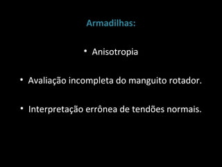 Armadilhas:

               • Anisotropia

• Avaliação incompleta do manguito rotador.

• Interpretação errônea de tendões normais.
 