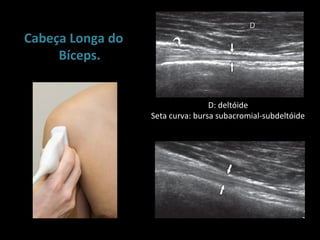 Cabeça Longa do
     Bíceps.


                                  D: deltóide
                  Seta curva: bursa subacromial-subdeltóide
 