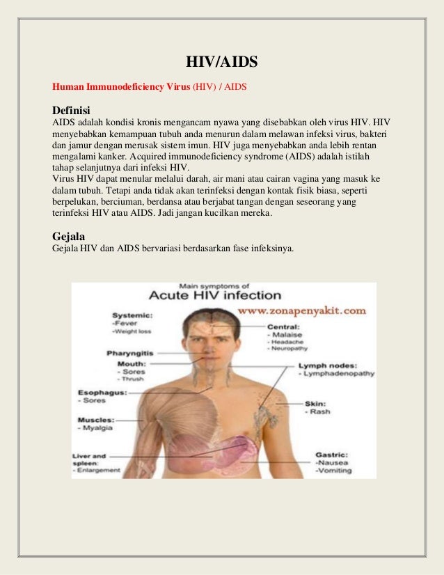 Artikel Hiv Aids