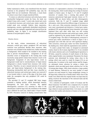 MASTER RESEARCH ARTICLE OF ANNE KASPERS, BIOMEDICAL IMAGE SCIENSES, UNIVERSITY MEDICAL CENTRE UTRECHT                                                        4

further mentioned as blobs, were transferred from the lateral                   inclusion of a representative selection of all shading areas in
ventricles to the peripheral CSF probability map; only the                      the training data, which would enlarge the overlap of structure
largest blob was not transferred. Afterwards, a visual check                    samples in feature space. In figure 4, T1 and T2 weighted
was done to move back wrongly transferred blobs.                                intensities of samples from a training data patient with
   To remove as subcortical structures and cortical grey matter                 numerous parenchymal high-signal intensity lesions on T2-
misclassified background outside the brain, the mask was                        weighted MRI are shown before and after inhomogeneity
eroded 2 times with a round, 7 voxels wide, kernel and voxels                   correction. Both the T1 and T2 weighted image added
of subcortical structures and cortical grey matter outside the                  information, which showed the different range of structures on
eroded mask were excluded. Infarcts, drain trajectories,                        the x- and y-axis. After correction, intensities of all structures
meningiomas, etcetera, significantly diminished classification                  were more concentrated and distinctive. Cortical grey matter,
outcome and were manually segmented and removed from the                        peripheral CSF and parenchymal lesion intensities were better
probability maps. In figure 3, an example classification                        separated from each other while there was still overlap
outcome of one participant is shown.                                            between subcortical structures and cortical grey matter, which
                                                                                could be explained by the unclear border in both the T1 and
                                                                                T2 weighted image. The effect of inhomogeneity correction to
 Routine choices                                                                cortical grey matter classification is shown in figure 5 for a
                                                                                participant scan with little and one with significant shading.
  In this study, volume measurements of subcortical                             After correction, cortical grey matter was better classified on
structures, cortical grey matter, peripheral CSF and lateral                    the shading area, which made the segmentation more uniform.
ventricles were performed. Besides these structures, other                        To create a proper brain mask, we designed an automated
structures were included in the masked area, further mentioned                  routine, based on the k-means algorithm [11]. It was extended
as background, which needed to be included in the training                      with cluster selection and a set of morphological operations to
data to prevent misclassification. Assignment of all not                        fill holes, caused by exclusion of small clusters in the brain,
classified voxels as background in the training data would                      while original borders were maintained. Parameters for cluster
incorrectly assign partial volume brain structure voxels to the                 selection were determined by testing values close to the
background. Assignment of only hypo-intense voxels as                           settings which were used in a study by Jongen [13] on our
background would lead to misclassification of hyper-intense                     training data. In contrast to the mask routine used by Jongen,
background to closely located brain structures with similar                     we automated cluster selection by setting a cluster size
intensity. Therefore, we put a manual selection of non-partial                  threshold, which provided good cluster selection for 9 of the
hypo- and hyper-intense background in the training data.                        10 training data images. After cluster selection, a large number
Remaining misclassified skull and fatty tissue classified as                    of small dilations, followed by one more number of small
subcortical structures and cortical grey matter was removed if                  erosions was used instead of a large morphologic closing, to
it was located within 6 voxels of the edge of the brain mask,                   fill large holes without loss of border detail. Holes close to the
under the assumption that only peripheral CSF could be                          border were filled while the original border was kept intact by
located there.                                                                  taking voxelwise the maximum of the unclosed mask and the
  The provided T1 and T2 weighted MR brain images                               closed, eroded mask.
contained a shading artefact, which diminished intensity                          For a selection of participants, results of k-means and the
homogeneity for each brain structure. We applied                                Brain Extraction Tool (BET) were compared [14]. In normal
inhomogeneity correction [12], assuming its effect to the                       cases BET performed similar to k-means, but in cases with
classification could be large since the orientation of the shaded               large infarcts k-means performed better. In k-means we could
area is different for each scan, which makes it hard to handle                  determine the number and selection of clusters to be classified.
by kNN. Preventive removal of shading seemed better than




  Fig. 3. A registered T1 and T2 weighted image and corresponding kNN probability maps of subcortical structures, cortical grey matter, peripheral CSF and
  lateral ventricles.
 