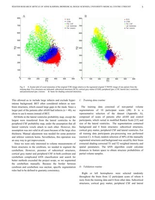 MASTER RESEARCH ARTICLE OF ANNE KASPERS, BIOMEDICAL IMAGE SCIENSES, UNIVERSITY MEDICAL CENTRE UTRECHT                                                              5




        Fig. 4 A. Scatter plot of voxel intensities of the original T2W image relative to the registered original T1WFFE image of one patient from the
        training data. Five structures are indicated: subcortical structures (SCS), cortical grey matter (CGM), peripheral (per.) CSF, lateral (lat.) ventricles
        and parenchymal (par.) lesions       B. Same for shading corrected intensities.



This allowed us to include large infarcts and exclude hyper-                        C. Training data routine
intense background. BET often considered infarcts as non-
brain structures, which caused large gaps in the mask. Since a                        The training data consisted of non-partial volume
larger part of the patients after aSAH had infarcts (n = 40), we                    segmentations of 10 participant scans (JB). It is a
chose to use k-means instead of BET.                                                representative selection of the dataset (Appendix A),
  All blobs in the lateral ventricles probability map, except the                   composed of scans of patients after aSAH and control
largest were transferred from the lateral ventricles to the                         participants, which varied in modified Rankin Scale [15] and
peripheral CSF probability map, under the assumption that all                       size of the lateral ventricles. The segmentations contained
lateral ventricle voxels attach to each other. However, this                        background and 4 brain structures: subcortical structures,
assumption was not valid in all cases because of the large slice                    cortical grey matter, peripheral CSF and lateral ventricles. For
thickness. Manual adjustment was needed for some posterior                          all training data participants pre-processing was performed
and inferior ventricle horns. Nevertheless, this operation was                      (section C). A fixed, random selection of 40% of the manually
an easy way to get improvement.                                                     segmented structures and background was saved by their brain
   Since we were only interested in volume measurements of                          extracted shading corrected T1 and T2 weighted intensity and
brain structures in the cerebrum, we needed to segment the                          spatial parameters. The kNN algorithm could calculate
cerebellum. However, presence of subcortical structures,                            distances in feature space to obtain structure probabilities of
cortical grey matter and peripheral CSF in both cerebrum and                        partial volume samples.
cerebellum complicated kNN classification and search for
better methods exceeded the project scope, so we segmented
the cerebellum manually. Because the border between
cerebrum and cerebellum was unclear, specific segmentation                          D. Validation routine
rules had to be defined to guaranty consistency.
                                                                                       Right or left hemispheres were selected randomly
                                                                                    throughout the brain from 12 participant scans of whom 6
                                                                                    were from the training data and 6 from other data. Subcortical
                                                                                    structures, cortical grey matter, peripheral CSF and lateral
 