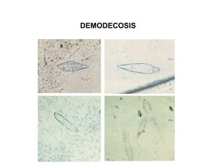 DEMODECOSIS
 