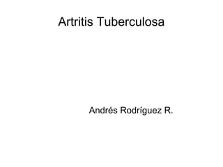 Artritis Tuberculosa Andrés Rodríguez R. 