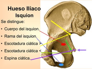 Isquion Se distingue: Cuerpo del isquion. Rama del isquion. Escotadura ciática >  Escotadura ciática <  Espina ciática. Hueso Ilíaco 