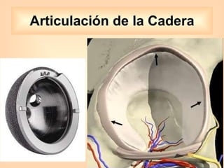 Articulación de la Cadera 