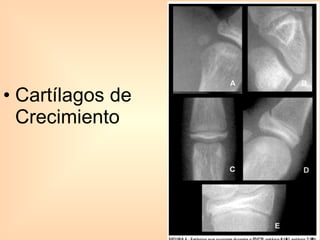 Cartílagos de Crecimiento 