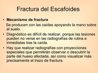 Fractura del Escafoides  Mecanismo de fractura  Se producen con las caídas apoyando la mano sobre el suelo. Diagnóstico es difícil de realizar, porque las lesiones pueden no verse en las radiografías de rutina e inmediatas tras la caída.  Hay que realizar radiografías con proyecciones especiales que permitirán observar o descubrir la parte del hueso afectada, así como visualizar más precisamente el trazo de fractura. 