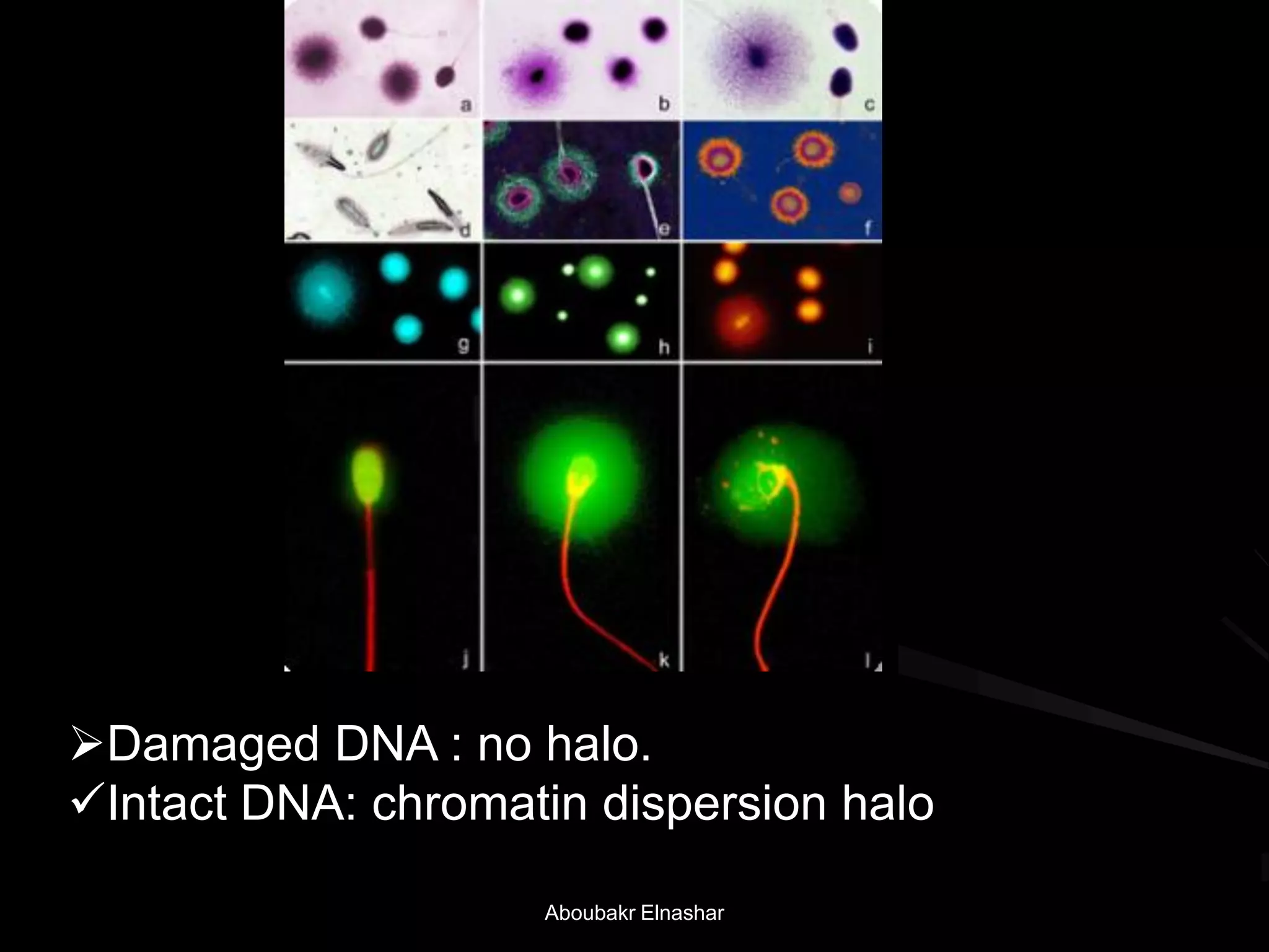 Damaged DNA : no halo.
Intact DNA: chromatin dispersion halo
Aboubakr Elnashar
 