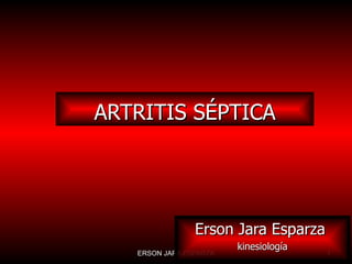 ARTRITIS SÉPTICA Erson Jara Esparza  kinesiología 