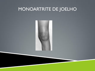 MONOARTRITE DE JOELHO

 
