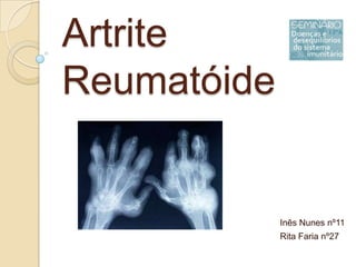 Artrite Reumatóide  Inês Nunes nº11 Rita Faria nº27 
