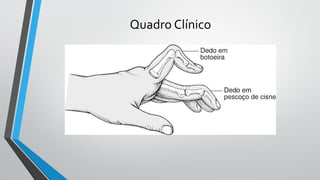 Quadro Clínico
 