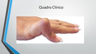 Quadro Clínico
 