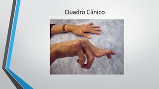 Quadro Clínico
 