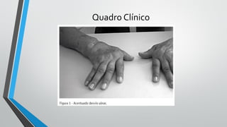 Quadro Clínico
 