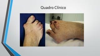 Quadro Clínico
 