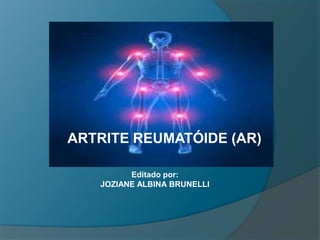 ARTRITE REUMATÓIDE (AR) Editado por: JOZIANE ALBINA BRUNELLI 