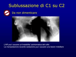 Da non dimenticare
Sublussazione di C1 su C2
L’AR puo’ causare un’instabilita’ asintomatica del collo
La manipolazione durante sedazione puo’ causare una lesion midollare
 