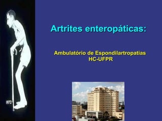 Artrites enteropáticas:   Ambulatório de Espondilartropatias  HC-UFPR 