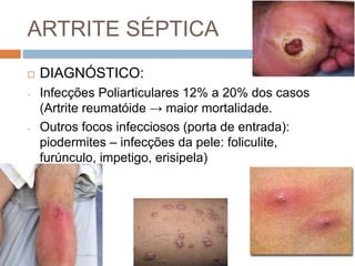 ARTRITE SÉPTICA
 DIAGNÓSTICO:
- Infecções Poliarticulares 12% a 20% dos casos
(Artrite reumatóide → maior mortalidade.
- Outros focos infecciosos (porta de entrada):
piodermites – infecções da pele: foliculite,
furúnculo, impetigo, erisipela)
 