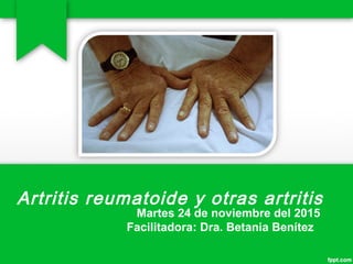 Artritis reumatoide y otras artritis
Martes 24 de noviembre del 2015
Facilitadora: Dra. Betania Benítez
 