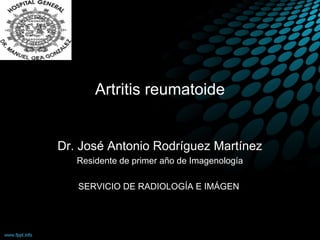 Artritis reumatoide
Dr. José Antonio Rodríguez Martínez
Residente de primer año de Imagenología
SERVICIO DE RADIOLOGÍA E IMÁGEN
 