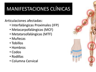 MANIFESTACIONES CLÍNICAS
Articulaciones afectadas:
• Interfalángicas Proximales (IFP)
• Metacarpofalángicas (MCF)
• Metatarsofalángicas (MTF)
• Muñecas
• Tobillos
• Hombros
• Codos
• Rodillas
• Columna Cervical
 