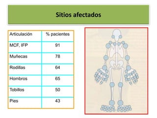 Sitios afectados
Articulación % pacientes
MCF, IFP 91
Muñecas 78
Rodillas 64
Hombros 65
Tobillos 50
Pies 43
 
