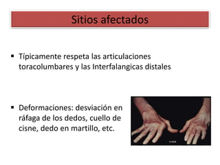 Sitios afectados
 Típicamente respeta las articulaciones
toracolumbares y las Interfalangicas distales
 Deformaciones: desviación en
ráfaga de los dedos, cuello de
cisne, dedo en martillo, etc.
 