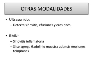 OTRAS MODALIDADES
• Ultrasonido:
– Detecta sinovitis, efusiones y erosiones
• RMN:
– Sinovitis inflamatoria
– Si se agrega Gadolinio muestra además erosiones
tempranas
 