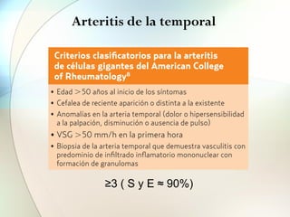Arteritis de la temporal
M.a
Victoria Zamora Sánchez
arteria temporal contralateral en casos seleccionados de
alta sospecha clínica. Los rasgos clínicos que se asocian
con mayor frecuencia a una biopsia positiva son la pre-
sencia de claudicación mandibular, diplopía o alteración
A priori,
canzar e
de duda
la PMR
bursitis
resonan
emisión
tan esto
pero con
plantear
paciente
de respu
sistente
marcado
Arterit
La biops
TABLA 2
Criterios clasificatorios para la arteritis
de células gigantes del American College
of Rheumatology8
• Edad !50 años al inicio de los síntomas
• Cefalea de reciente aparición o distinta a la existente
• Anomalías en la arteria temporal (dolor o hipersensibilidad
a la palpación, disminución o ausencia de pulso)
• VSG !50 mm/h en la primera hora
• Biopsia de la arteria temporal que demuestra vasculitis con
predominio de infiltrado inflamatorio mononuclear con
formación de granulomas
≥3 ( S y E ≈ 90%)
 