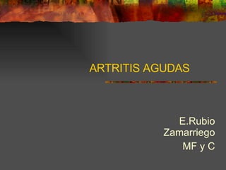 ARTRITIS AGUDAS  E.Rubio Zamarriego MF y C 