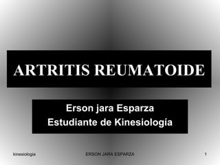 ARTRITIS REUMATOIDE Erson jara Esparza Estudiante de Kinesiología 