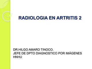 DR.HILGO AMARO TINOCO.
JEFE DE DPTO DIAGNOSTICO POR IMÁGENES
HNHU
RADIOLOGIA EN ARTRITIS 2
 