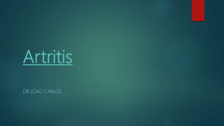 Artritis
DR JOAO CARLOS
 