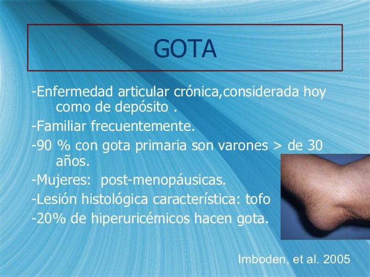 Artritis Gotosa