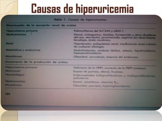 Causas de hiperuricemia
 