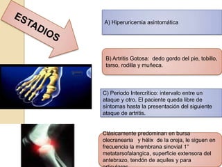 A) Hiperuricemia asintomática




 B) Artritis Gotosa: dedo gordo del pie, tobillo,
 tarso, rodilla y muñeca.




C) Periodo Intercrítico: intervalo entre un
ataque y otro. El paciente queda libre de
síntomas hasta la presentación del siguiente
ataque de artritis.


Clásicamente predominan en bursa
olecranearia y hélix de la oreja, le siguen en
frecuencia la membrana sinovial 1°
metatarsofalangica, superficie extensora del
antebrazo, tendón de aquiles y para
 