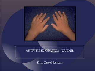 ARTRITIS IDIOPATICA JUVENIL
Dra. Zusel Salazar
 