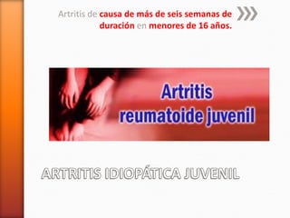 Artritis de causa de más de seis semanas de
duración en menores de 16 años.
 