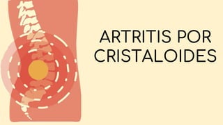 ARTRITIS POR
CRISTALOIDES
 