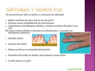 Se caracteriza por dolor y rigidez en articulaciones afectadas
 Rigidez matutina que dura más de 30 min (50%)
 Presenta menor sensibilidad de las articulaciones
 Articulaciones interfalángicas distales y columna vertebral afectadas en un
50%
EF: dolor en línea articular y derrames en articulaciones , a menudo con
distribución asimétrica
 Dactilitis (40%)
 Lesiones uña (80%)
 Edema con fóvea en extremidad distal (20%)
 Entensitis del tendón de Aquiles, fascia plantar y hueso pelvis
 Uveítis anterior (7-33%)
 