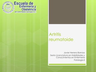 Artritis reumatoide  Javier Herrera Barroso Sexto Licenciatura en Habilidades y Conocimientos en Enfermería Patología II 