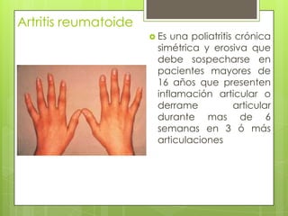 Artritis reumatoide Es una poliatritis crónica simétrica y erosiva que debe sospecharse en pacientes mayores de 16 años que presenten inflamación articular o derrame articular durante mas de 6 semanas en 3 ó más articulaciones 