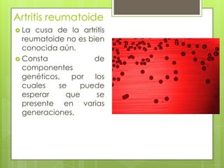 Artritis reumatoide La cusa de la artritis reumatoide no es bien conocida aún.Consta de componentes genéticos, por los cuales se puede esperar que se presente en varias generaciones.