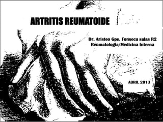 ARTRITIS REUMATOIDE
             Dr. Aristeo Gpe. Fonseca salas R2
              Reumatologia/Medicina Interna




                                ABRIL 2013
 